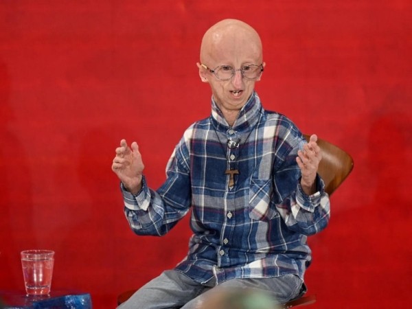 Умер самый долгоживущий человек с синдромом преждевременного старения — ему было 28 лет Умер самый долгоживущий человек с синдромом преждевременного старения — ему было 28 лет